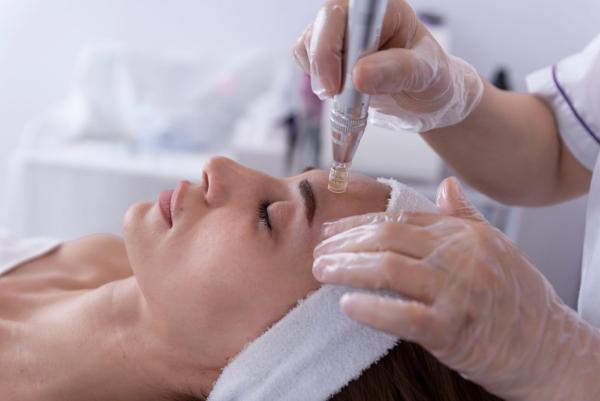 Skin needling